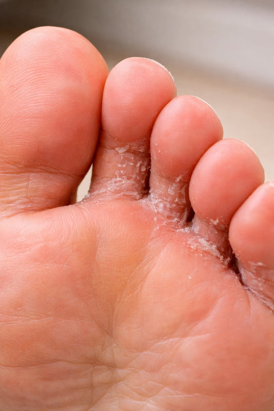 Why Foot Issues Are Common After Travel | Hygiene & Foot Care Tips